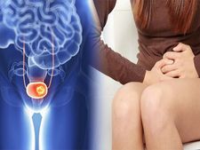 ಓವರ್‌ಆ್ಯಕ್ಟಿವ್‌ ಬ್ಲಾಡರ್‌ ಸಮಸ್ಯೆಗೆ ಯಾವ ಆಹಾರ ಹಾಗೂ ಪಾನೀಯ ಒಳ್ಳೆಯದು?