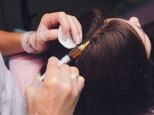 ಕೂದಲು ಕಸಿ ಮಾಡಿಸುವುದರ ಅಡ್ಡ ಪರಿಣಾಮಗಳೆಷ್ಟು ಗೊತ್ತಾ?