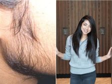 ಫೇಶಿಯಲ್ ಹೇರ್ ಶಾಶ್ವತವಾಗಿ ಹೋಗಲಾಡಿಸುವುದು ಹೇಗೆ? ನ್ಯೂಟ್ರಿಷಿಯನಿಸ್ಟ್‌  ರಾಶಿ ಚೌಧರಿ ಏನು ಹೇಳಿದ್ದಾರೆ ನೋಡಿ