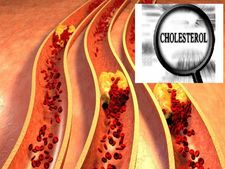 ಈ ತ್ವಚೆ ಸಮಸ್ಯೆಗಳು ಕಂಡು ಬಂದರೆ ಕೊಲೆಸ್ಟ್ರಾಲ್  ಹೆಚ್ಚಾಗಿದೆ ಎಂಬುವುದರ ಲಕ್ಷಣ, ಹುಷಾರ್!