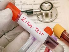 ಕರ್ನಾಟಕದಲ್ಲಿ ಮೊದಲ ಬಾರಿಗೆ ಝೀಕಾ ವೈರಸ್ ಸೋಂಕು ಪತ್ತೆ: ಈ ಅಪಾಯಕಾರಿ ಕಾಯಿಲೆಯ ಲಕ್ಷಣಗಳೇನು? ತಡೆಗಟ್ಟಬಹುದೇ?