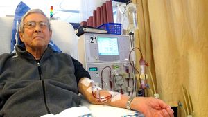 World Kidney Day : ಕಿಡ್ನಿ ಡಯಾಲಿಸಿಸ್: ಕಿಡ್ನಿ ಡಯಾಲಿಸಿಸ್ ವಿಧಗಳೇನು? ಡಯಾಸಿಸ್  ಹೇಗೆ  ಮಾಡಲಾಗುವುದು?