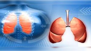 2024 ವಿಶ್ವ ಕ್ಷಯ ರೋಗ ದಿನ: ಕ್ಷಯ ರೋಗದ ಅಪಾಯಗಳೇನು, ತಡೆಗಟ್ಟುವುದು ಹೇಗೆ?