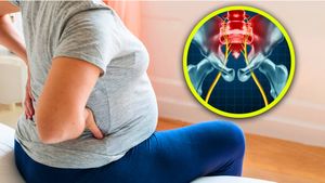ಗರ್ಭಾವಸ್ಥೆಯಲ್ಲಿ ಕಾಡುವ ಸಯಾಟಿಕ ನೋವು ಕಡಿಮೆ ಮಾಡುವುದು ಹೇಗೆ?