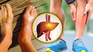 ಫ್ಯಾಟಿ ಲಿವರ್:  ನಡೆಯುವಾಗ ಈ ಸಮಸ್ಯೆ ಕಂಡು ಬಂದರೆ ಫ್ಯಾಟಿ ಲಿವರ್ ಇರಬಹುದು?