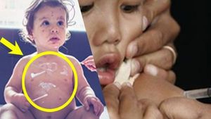 27 ಮಕ್ಕಳಿಗೆ ದಡಾರ ಶಂಕೆ..ಇಬ್ಬರು ಸಾವು..! 8 ಶಾಲೆಗಳು ಬಂದ್..! ದಡಾರ ಹರಡೋದು ಹೇಗೆ?