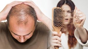 ಬೇಸಿಗೆಯಲ್ಲಿ ಕೂದಲು ಉದುರುವುದನ್ನು ತಡೆಯೋದು ಹೇಗೆ.? ಯಾವ ಎಣ್ಣೆ ಬಳಸಬೇಕು.?