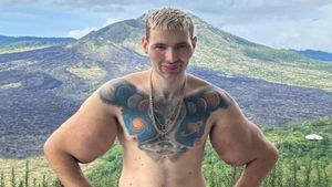 ಕೈಗಳಿಗೆ 6 ಲೀಟರ್ ವ್ಯಾಸಲಿನ್ ಚುಚ್ಚಿಕೊಂಡ ಯುವಕ..! ಆಮೇಲೆ ಆಗಿದ್ದೇನು?