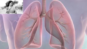 ಕ್ಯಾನ್ಸರ್‌ಗೆ  ನಿರೂಪಕಿ ಅಪರ್ಣ ಬಲಿ:  ಶ್ವಾಸಕೋಶದ ಕ್ಯಾನ್ಸರ್‌ ಲಕ್ಷಣಗಳೇನು? ಚಿಕಿತ್ಸೆಯೇನು?