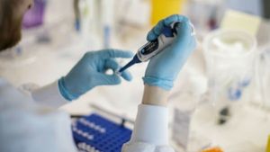 ನಿಗೂಢ ಕಾಯಿಲೆಗೆ ಮೂರು ಕುಟುಂಬದ 17 ಮಂದಿ ಮೃತ್ಯು..! ಆರೋಗ್ಯ ಇಲಾಖೆಗೆ ತಲೆನೋವು..!