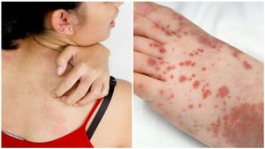 ಚರ್ಮದ ಮೇಲೆ ಈ ಲಕ್ಷಣವಿದ್ದರೆ ನಿರ್ಲಕ್ಷಿಸಬೇಡಿ..! ಮಧುಮೇಹದ ಆರಂಭ ಇರಬಹುದು.!!