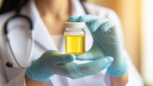 ಬೆಳಗ್ಗೆಯ ಮೂತ್ರ ಹಳದಿ ಬಣ್ಣದಿಂದ ಕೂಡಿದ್ಯಾ.? ನಿರ್ಲಕ್ಷಿಸಿದರೆ ಏನಾಗುತ್ತೆ?