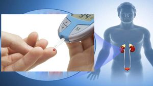 ಮಧುಮೇಹವಿದ್ದರೆ ಕಿಡ್ನಿ  ವೈಫಲ್ಯ ಉಂಟಾಗುವುದೇ? ಆರಂಭಿಕ ಲಕ್ಷಣಗಳೇಣು?