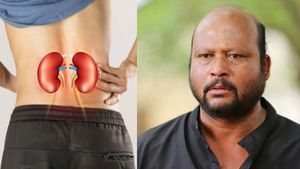 Fish Venkat: ಫಿಶ್ ವೆಂಕಟ್ ನಿಧನ.. ಈ ರೋಗವೇ ಜೀವ ತೆಗೆದಿದ್ದು! ಈ ತಪ್ಪುಗಳನ್ನು ನೀವು ಮಾಡಬೇಡಿ