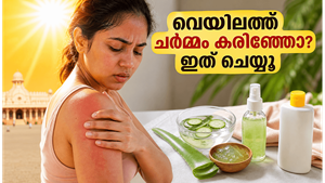 കഠിനമായ വേനൽച്ചൂടിൽ ചർമ്മം കരിഞ്ഞുപോകുമോ? വെയിലിൽ നിന്ന് രക്ഷനേടാൻ ഈ പൊടിക്കൈകൾ പരീക്ഷിക്കൂ
