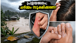 പ്രളയജലത്തിൽ ഇറങ്ങുന്നുണ്ടോ? ചർമ്മരോഗങ്ങൾ വരാതിരിക്കാൻ ഈ മുൻകരുതലുകൾ നിർബന്ധം