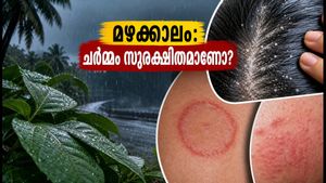 മഴക്കാലത്ത് ചർമ്മവും മുടിയും സംരക്ഷിക്കണോ? ഈ ചെറിയ കാര്യങ്ങൾ ശ്രദ്ധിച്ചില്ലെങ്കിൽ പണി പാളും