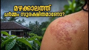 മഴക്കാലത്ത് ചർമ്മവും തലയോട്ടിയും സുരക്ഷിതമാണോ? അണുബാധകളെ തടയാൻ ഈ മുൻകരുതലുകൾ എടുക്കൂ