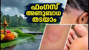 മഴക്കാലത്തെ ഫംഗസ് അണുബാധയും താരനും: ചർമ്മം സുരക്ഷിതമാക്കാൻ ഈ ലളിതമായ വഴികൾ പരീക്ഷിക്കൂ