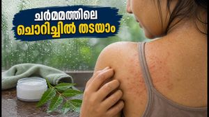 മഴക്കാലത്ത് ചർമ്മത്തിൽ ചൊറിച്ചിലും കുരുക്കളും? അണുബാധ തടയാൻ ഈ കാര്യങ്ങൾ ശ്രദ്ധിക്കൂ