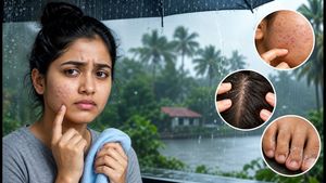 മഴക്കാലത്ത് ചർമ്മത്തിൽ ചൊറിച്ചിലും കുരുക്കളും? ഈ തെറ്റുകൾ ചെയ്താൽ പണി പാളും!