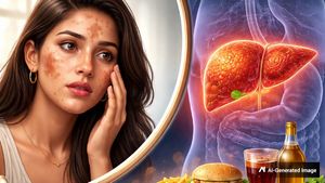 கரும்புள்ளிகளை சாதாரணமா நினைக்காதீங்க.. அது கல்லீரல் பிரச்சனையின் அறிகுறியா இருக்கலாம்.. உஷார்..