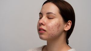 முகத்தில் உள்ள கரும்புள்ளிகளை நீக்கணுமா? அப்ப அரிசி கழுவிய நீரை இப்படி யூஸ் பண்ணுங்க! 