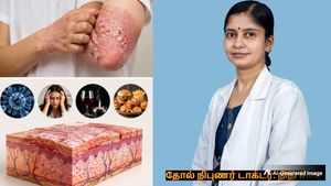 சொரியாசிஸ் பற்றி ஒவ்வொருவரும் கட்டாயம் தெரிஞ்சுக்க வேண்டிய விஷயங்களை பகிர்ந்து கொண்ட டாக்டர்! 