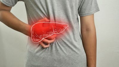 हैदराबाद में 84% IT कर्मचारी हुए फैटी लिवर के शिकार, ये लक्षण दिखें तो तुरंत करें डॉक्टर से संपर्क