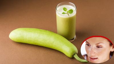 Lauki Side Effects: लौकी के साथ भूलकर भी न खाएं ये 5 चीजें, वरना चेहरे पर हो सकते हैं सफेद दाग