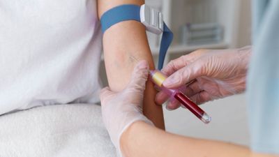 Kolar Woman Has World's Rarest Blood: What Does CRIB Group Mean? Can They Donate Or Receive Blood?