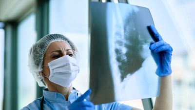 World Lung Cancer Day 2025: Lung Cancer Vs Asthma, Double Check Symptoms Before It's Too Late