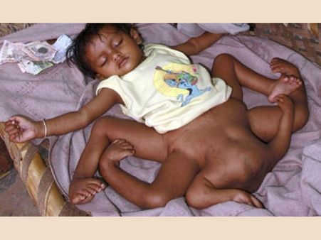 লক্ষ্মী তাতমা