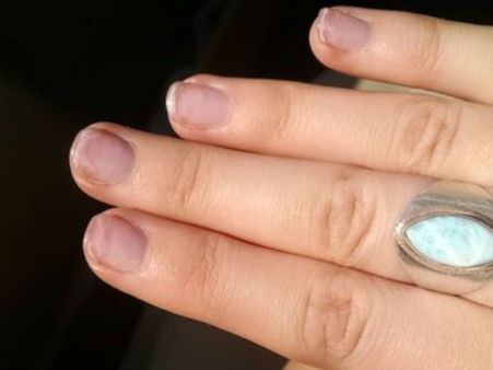 এবড়ো খেবড়ো ছোট নখ