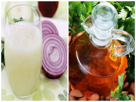 পেঁয়াজের রস এবং আমন্ড অয়েল