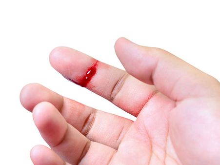 ৬.ছোটিখাট ত্বকের সমস্যা সারায় 