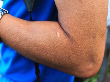 ৮. গায়ে কাঁটা দেওয়া: ৮. গায়ে কাঁটা দেওয়া: