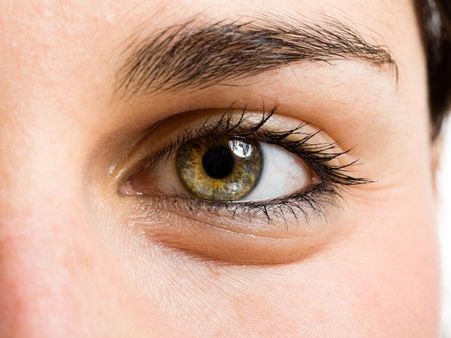 ৪. ত্বকের শুষ্কতা দূর করে: