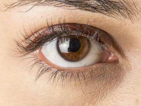 ১. মণির রং বাদামী হলে: