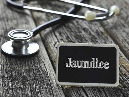 ৭. জন্ডিস: