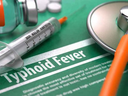 ৩. টাইফয়েড: