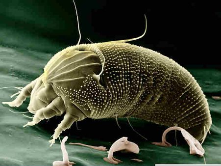 ১১. অ্যালার্জির প্রকোপ কমায়: