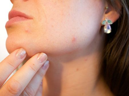 ৬. ত্বকের সংক্রমণ সারাতে কাজে আসে: