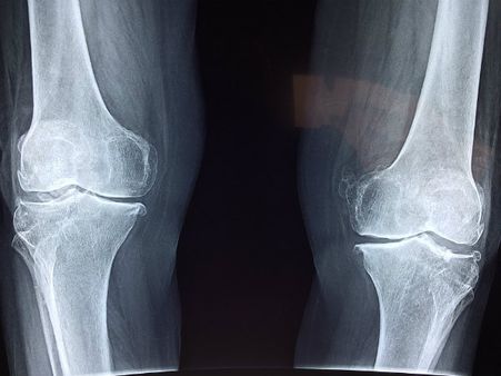 ৩. হাড় শক্তোপোক্ত হয়: