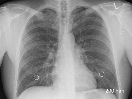 ৫. ওজন গ্যাসের মার থেকে বাঁচাও সম্ভব হয় না: