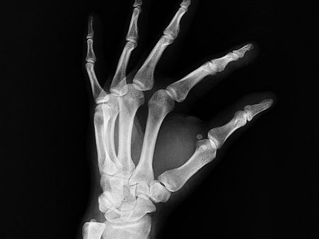 ৫. হাড়ের স্বাস্থ্যের উন্নতি ঘটায়: