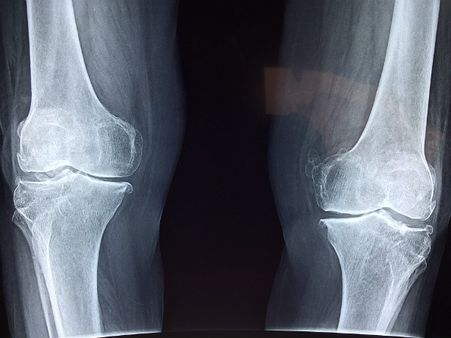 ৭. হাড় শক্তপোক্ত হয়: