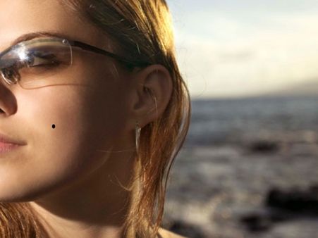 আঁচিলকেও নজর রাখতে হবে: