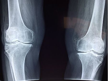 ৩. হাড় শক্তপোক্ত হয়: