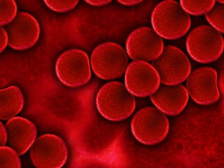 ৩. খারাপ কোলেস্টেরলের মাত্রা কমায়: ৩. খারাপ কোলেস্টেরলের মাত্রা কমায়: